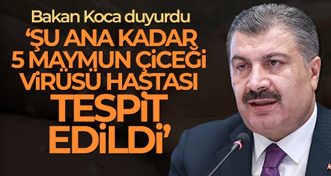 Bakan Koca: 'Şu ana kadar ülkemizde 5 maymun çiçeği virüsü hastası tespit edildi'