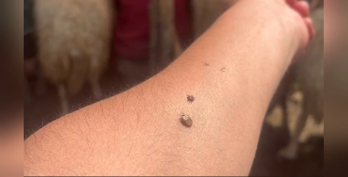 Erzincan'da KKKA Uyarısı: Vatandaşlar Tedbirli Olmalı