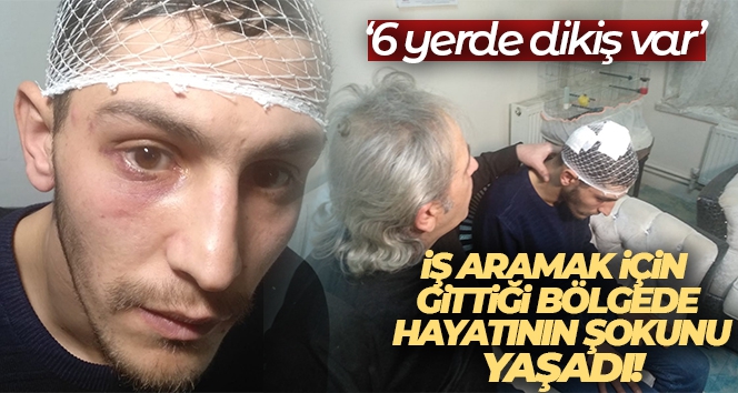 İş aramak için gittiği bölgede önce darp, ardından da gasp edildi