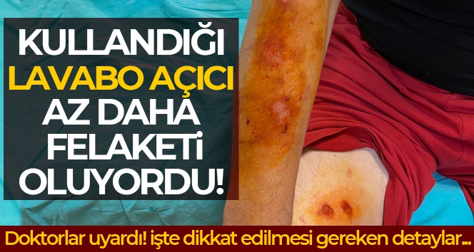 Lavabo açıcı bomba gibi patladı, soluğu hastanede aldı