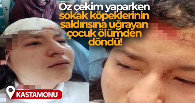 Öz çekim yaparken sokak köpeklerinin saldırısına uğrayan çocuk ölümden döndü