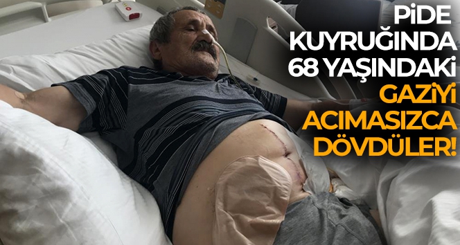 Pide almak için girdiği kuyrukta 68 yaşındaki Kıbrıs gazisini acımadan dövdüler