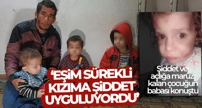 Şiddet ve açlığa maruz kalan çocuğun babası konuştu